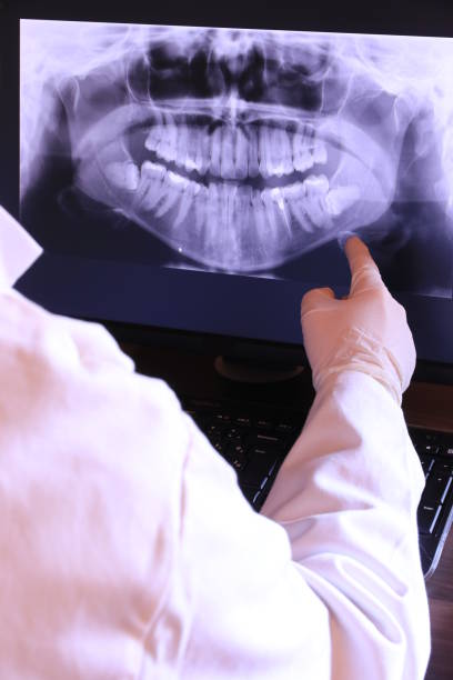 Best Tooth Infection Emergency Dentist  in Sea Isle City, NJ