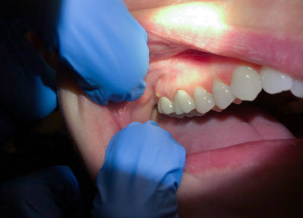 Best Cracked Tooth Emergency Dentist  in Sea Isle City, NJ